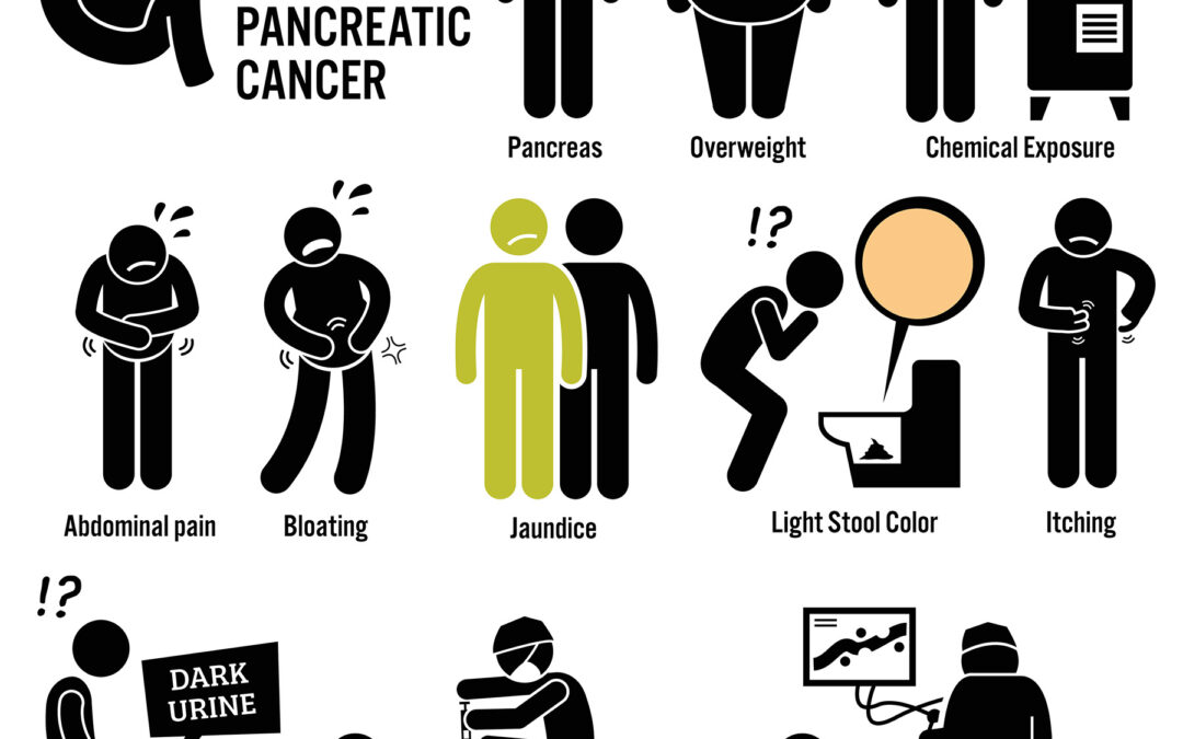 PANCREATIC CANCER SYMPTOMS AND TREATMENT