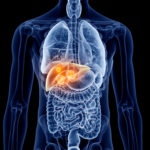 cancer in the liver - liver cancer treatment options - liver cancer surgery alternatives