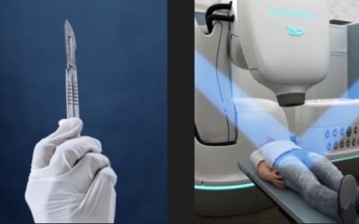 The Scalpel vs. CyberKnife and Beyond