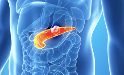 Is Cancer of the Liver Curable?