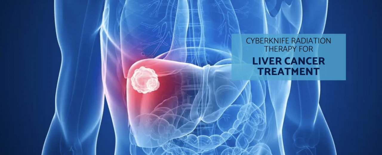 CyberKnife vs. Surgery For Liver Cancer Treatment - CyberKnife Miami