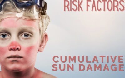 4th of July Sun Safety Reminders for a Lifetime